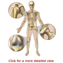 Don F. Mills, MD - Pain Management - Interventional Pain Management Specialist in Irvine, California